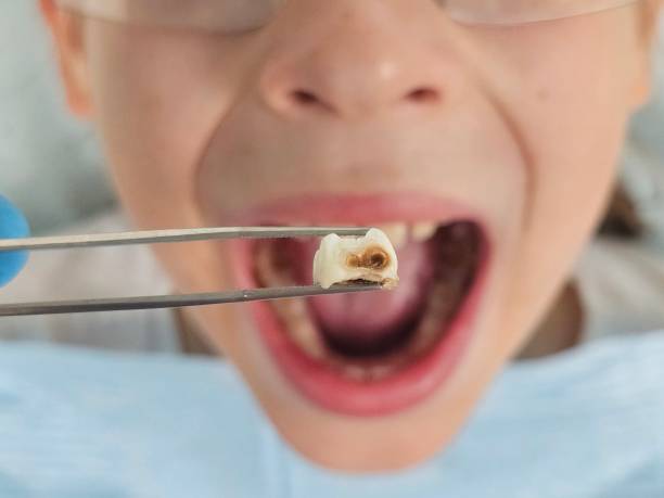 Best Pediatric Emergency Dentist in Bing, OR